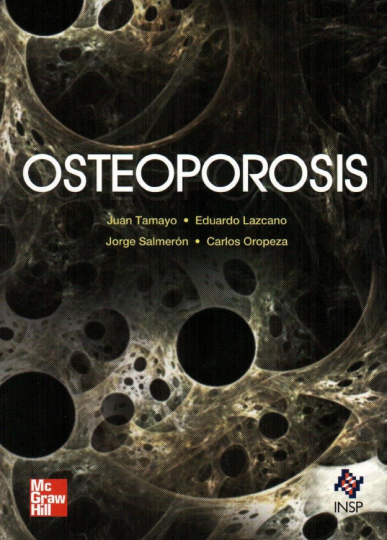 Osteoporosis